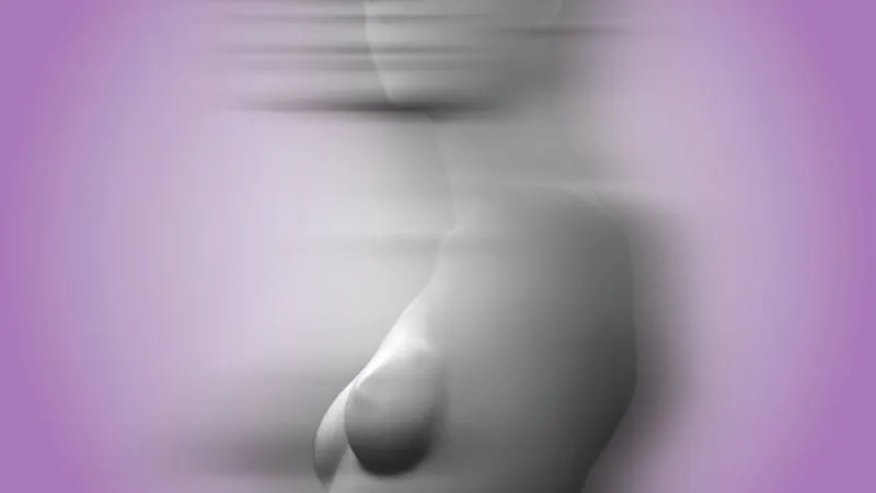 Breast explant surgery on rise...