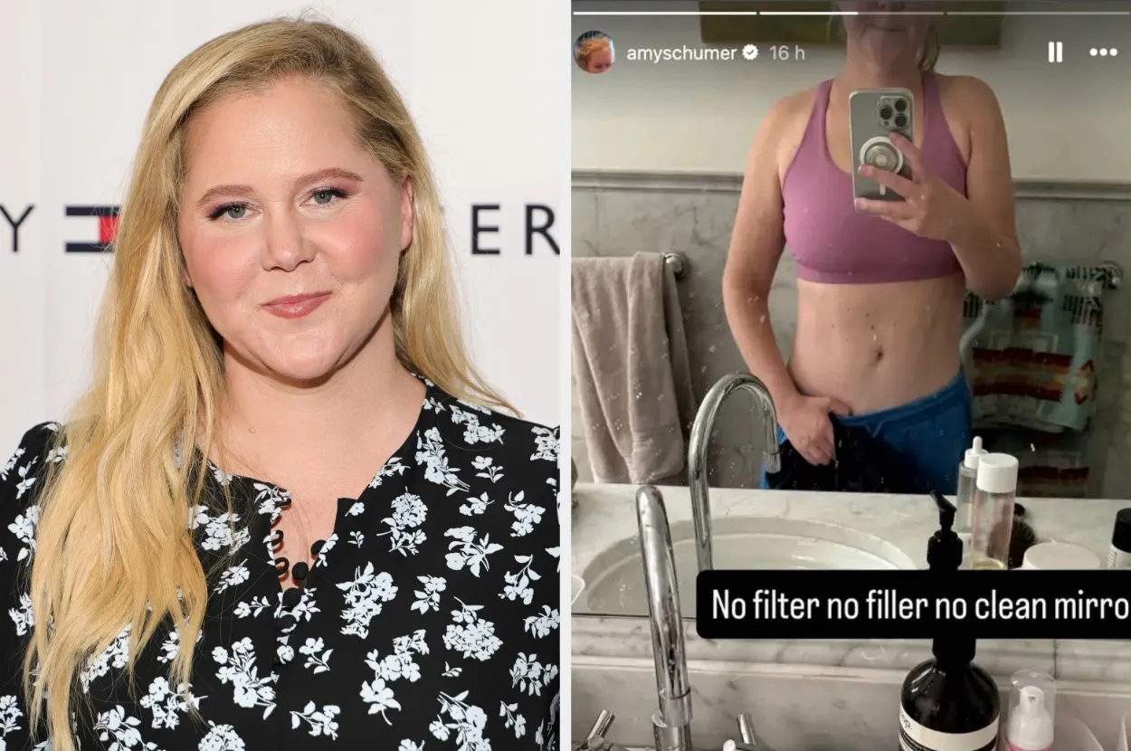 After Her Unfiltered Body Selfie Went Viral, Amy Schumer Said She’s “Enjoying” How She Looks And Shared More Photos Of Herself Post-Mounjaro